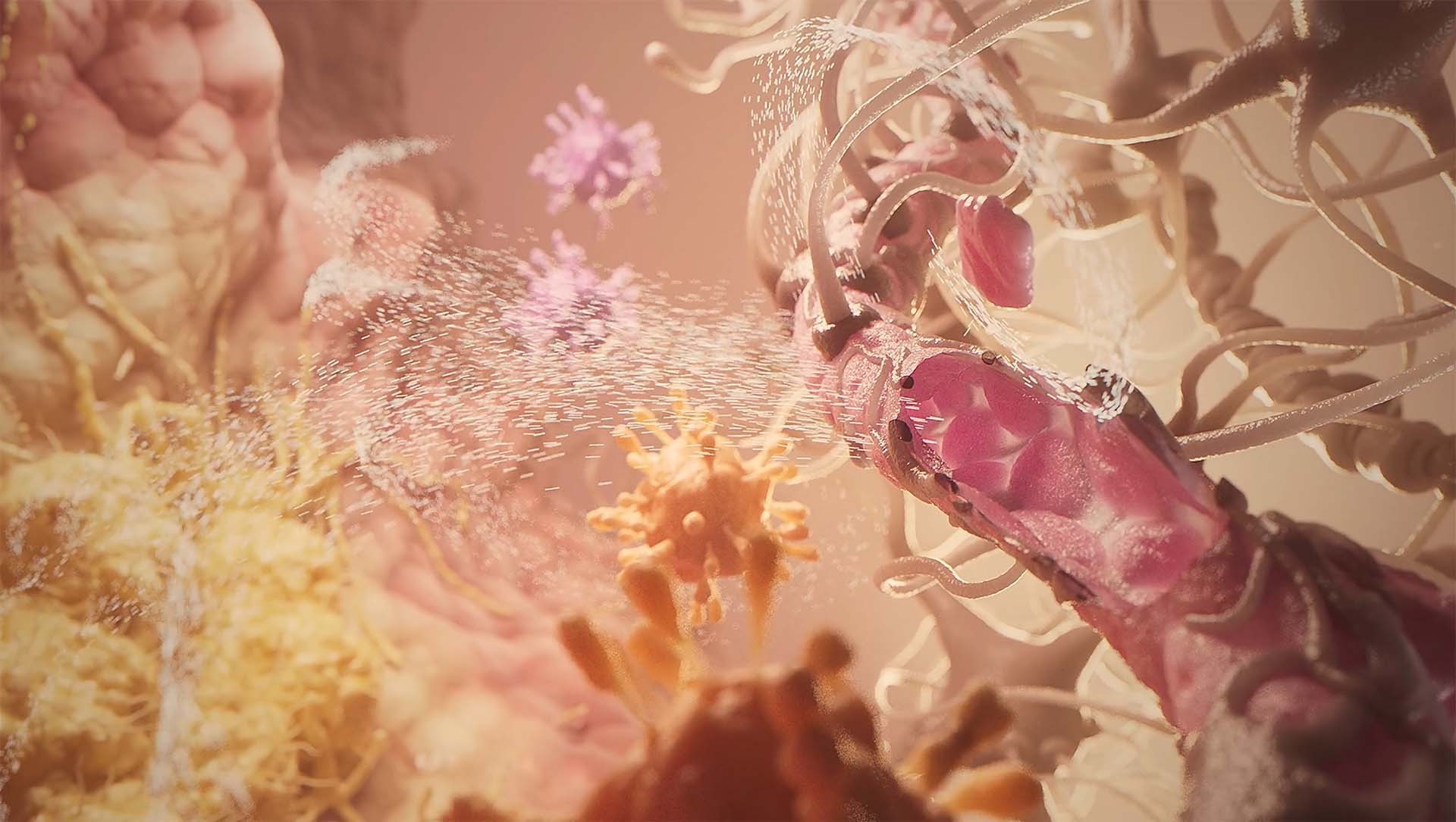 3D animation depicting brain tumour in various colours