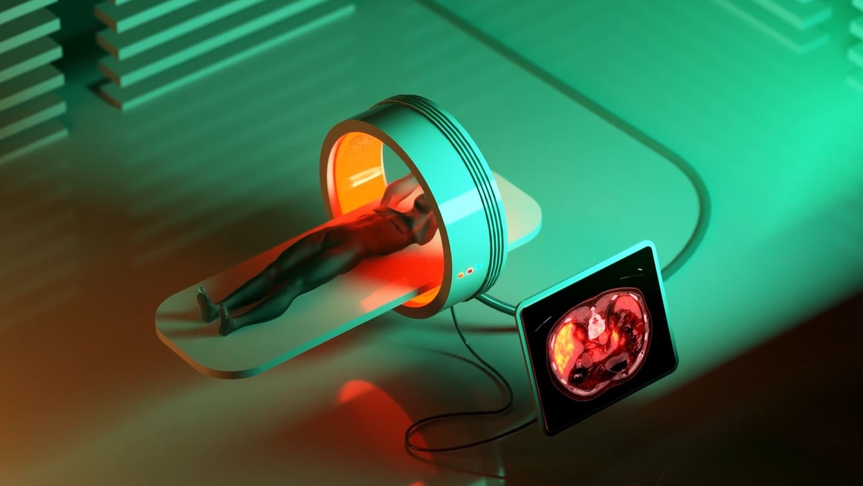 3d animation Artistic impression of MRI scan in green and orange.jpg