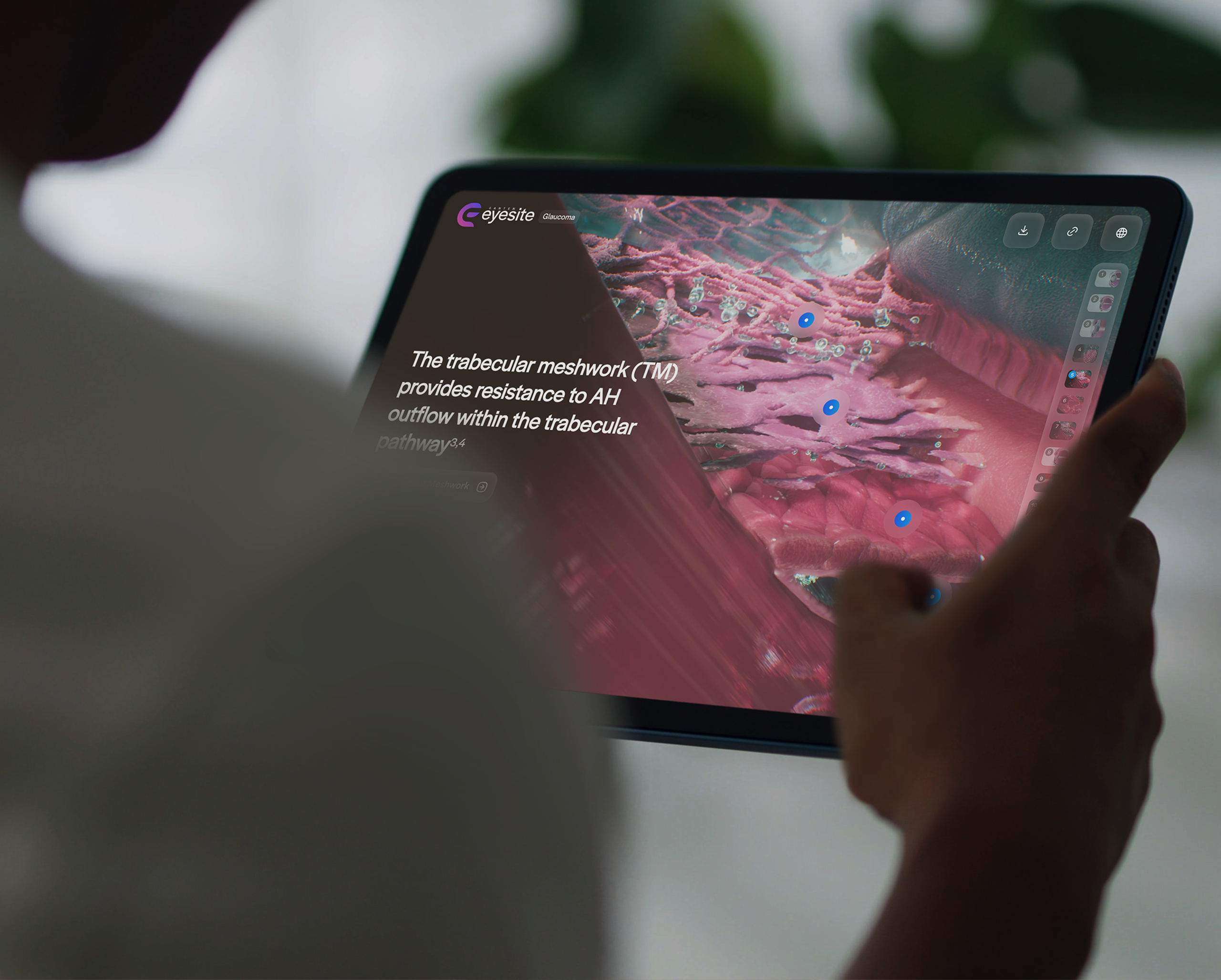 Santen Eyesite case overview thumbnail.png